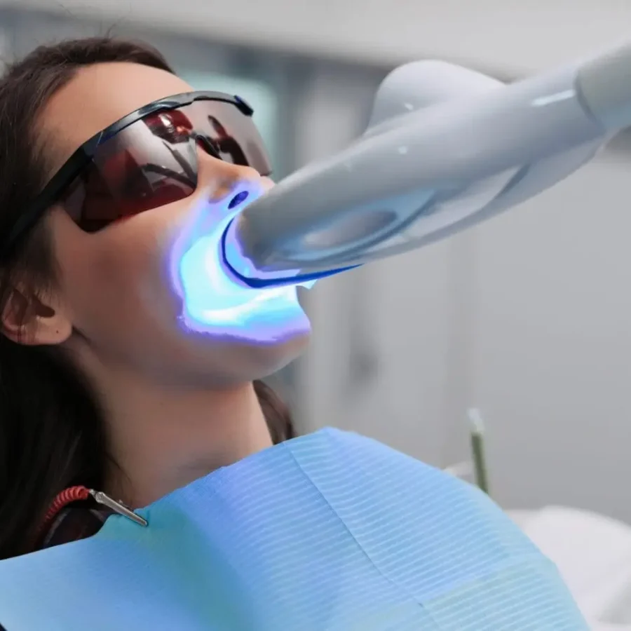 Teeth,Whitening,For,Woman.,Bleaching,Of,The,Teeth,At,Dentist